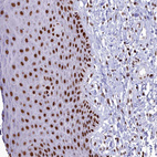 Immunohistochemical staining of human skin shows strong nuclear positivity in squamous epithelial cells.