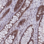 Immunohistochemical staining of human rectum shows strong nuclear positivity in glandular cells.