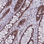 Immunohistochemical staining of human rectum shows strong nuclear positivity in glandular cells.