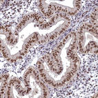 Immunohistochemical staining of human endometrium shows moderate nuclear positivity in glandular cells.