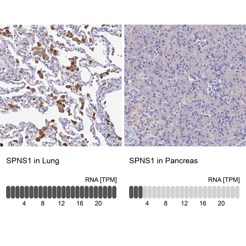 Anti-SPNS1 Antibody
