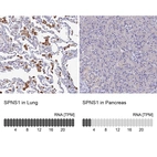 Anti-SPNS1 Antibody