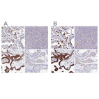 Immunohistochemical staining of human lung, pancreas, placenta and testis using Anti-SPNS1 antibody HPA042988 (A) shows similar protein distribution across tissues to independent antibody HPA041995 (B).