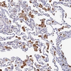 Immunohistochemical staining of human lung shows moderate granular cytoplasmic positivity in macrophages.