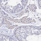 Immunohistochemical staining of human testis shows weak cytoplasmic positivity in Leydig cells.