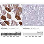 Anti-MYBPC2 Antibody