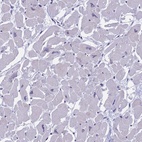 Immunohistochemical staining of human heart muscle shows low expression as expected.