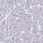 Anti-MYBPC2 Antibody