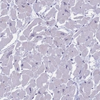 Immunohistochemical staining of human heart muscle shows low expression as expected.