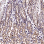 Anti-WDR5B Antibody
