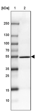 Lane 1: Marker [kDa] 250, 130, 100, 70, 55, 35, 25, 15, 10_br/_Lane 2: Human Liver tissue