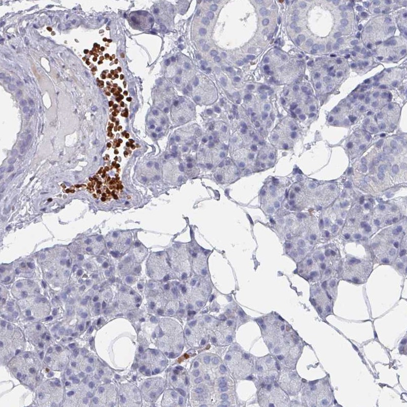 Anti-POLR2J Antibody