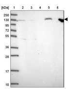 Lane 1: Marker [kDa] 250, 130, 95, 72, 55, 36, 28, 17, 10_br/_Lane 2: Human cell line RT-4_br/_Lane 3: Human cell line U-251 MG_br/_Lane 4: Human plasma_br/_Lane 5: Human Liver tissue_br/_Lane 6: Human Tonsil tissue