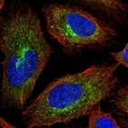 Immunofluorescent staining of human cell line U-2 OS shows localization to vesicles.