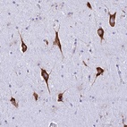 Anti-RPL19 Antibody