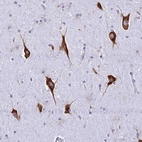 Anti-RPL19 Antibody