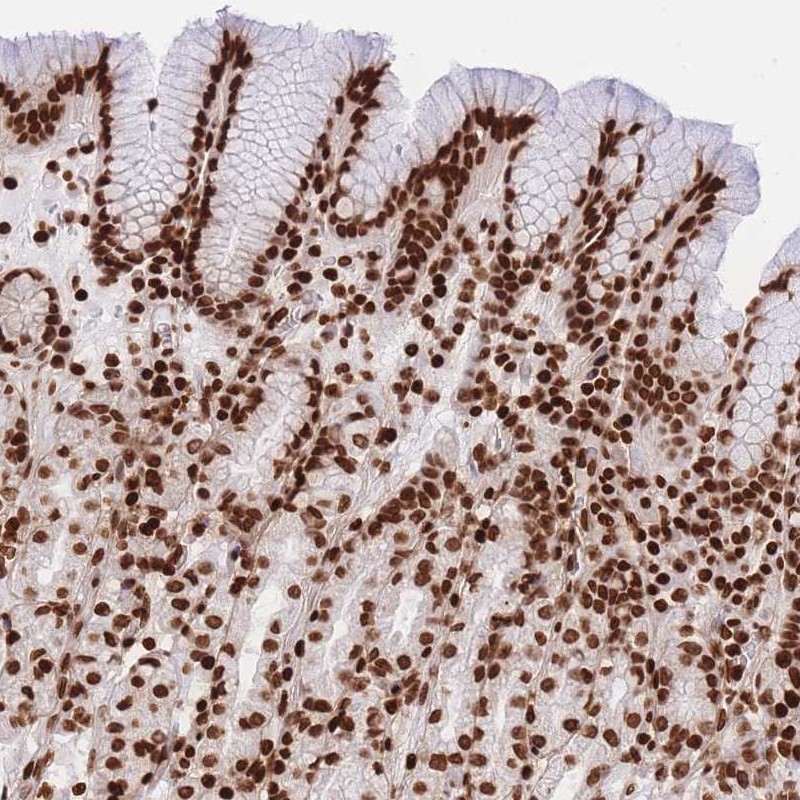 Anti-HIST2H2BE Antibody