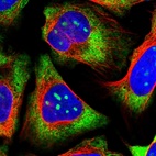 Immunofluorescent staining of human cell line U-2 OS shows localization to nucleoli, cytosol & endoplasmic reticulum.