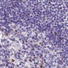 Anti-CASC4 Antibody