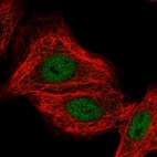 Anti-CLCN7 Antibody