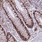 Anti-ARMCX6 Antibody