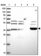 Lane 1: Marker [kDa] 250, 130, 95, 72, 55, 36, 28, 17, 10_br/_Lane 2: Human cell line RT-4_br/_Lane 3: Human cell line U-251MG sp_br/_Lane 4: Human plasma (IgG/HSA depleted)_br/_Lane 5: Human liver tissue