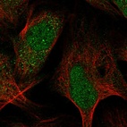 Immunofluorescent staining of human cell line U-2 OS shows localization to nucleus & cytosol.