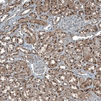 Immunohistochemical staining of human Kidney shows strong nuclear positivity in cells in tubules.