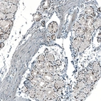 Immunohistochemical staining of human Duodenum shows strong nuclear positivity in glandular cells.