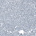 Immunohistochemical staining of human Liver shows very weak nuclear positivity in hepatocytes.