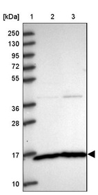 Lane 1: Marker [kDa] 250, 130, 95, 72, 55, 36, 28, 17, 10_br/_Lane 2: Human cell line RT-4_br/_Lane 3: Human cell line U-251 MG
