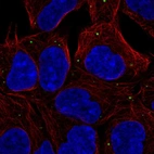Anti-EDC4 Antibody