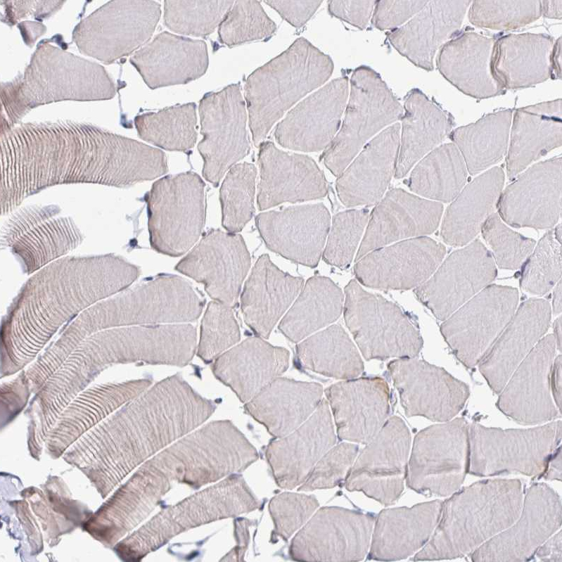 Anti-RNASEH1 Antibody