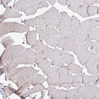 Anti-RNASEH1 Antibody