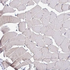 Anti-RNASEH1 Antibody