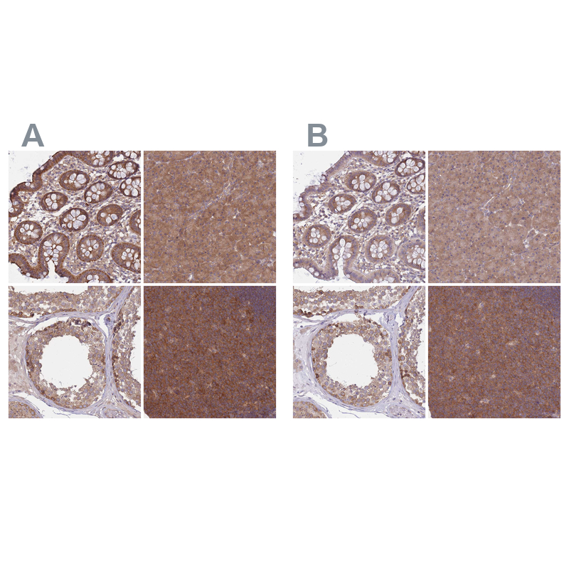 Anti-PFDN6 Antibody