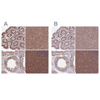 Anti-PFDN6 Antibody