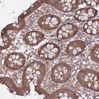 Immunohistochemical staining of human colon shows moderate cytoplasmic positivity in glandular cells.