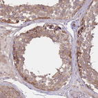 Anti-PFDN6 Antibody