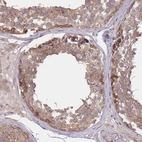 Immunohistochemical staining of human testis shows moderate cytoplasmic positivity in cells in seminiferous ducts.