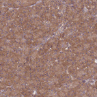 Immunohistochemical staining of human pancreas shows moderate cytoplasmic positivity in exocrine glandular cells.