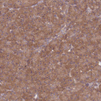 Anti-PFDN6 Antibody