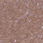 Immunohistochemical staining of human pancreas shows moderate cytoplasmic positivity in exocrine glandular cells.