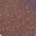 Immunohistochemical staining of human tonsil shows moderate cytoplasmic positivity in germinal center cells.