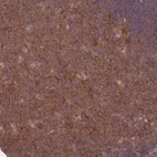 Immunohistochemical staining of human tonsil shows moderate cytoplasmic positivity in germinal center cells.