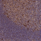 Anti-THUMPD2 Antibody
