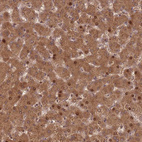 Immunohistochemical staining of human liver shows moderate cytoplasmic positivity in hepatocytes.