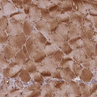 Immunohistochemical staining of human skeletal muscle shows moderate cytoplasmic positivity in myocytes.