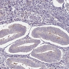 Immunohistochemical staining of human endometrium shows no positivity in glandular cells as expected.
