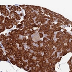 Anti-TRAPPC6A Antibody